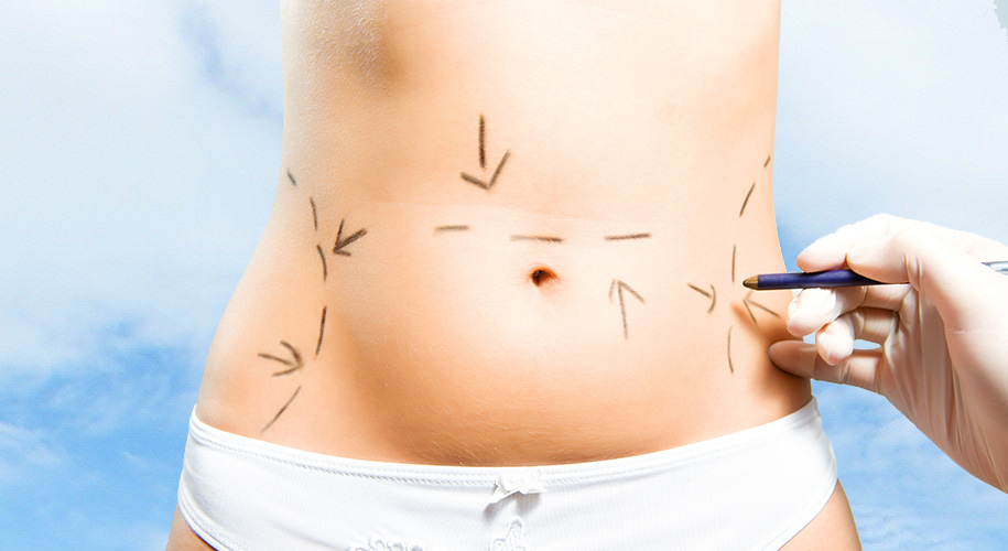 Liposoft Review, Liquid Liposuction